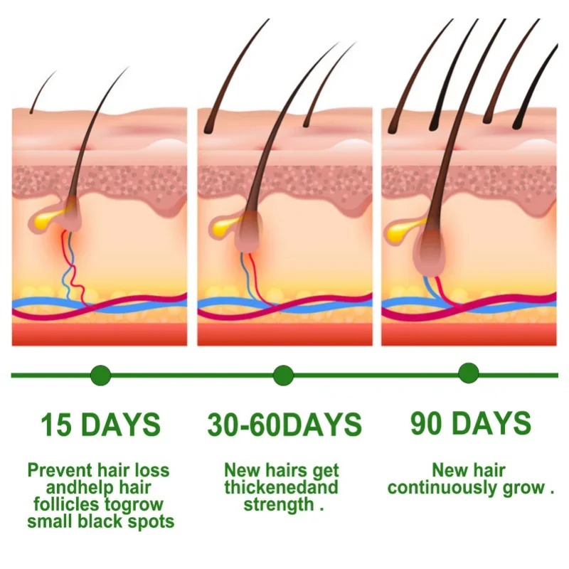 Saç Büyüme Serumu Hızlı Büyüye - Beard Oil Growth incelemesi ve fiyatı