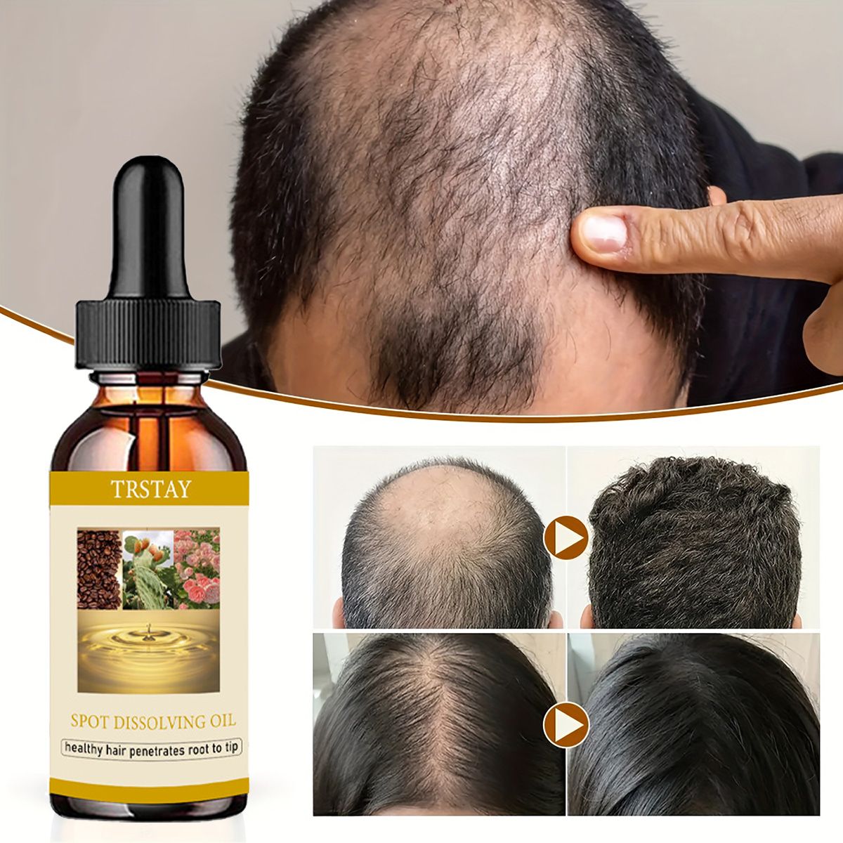 50ML sakal uzatma yağ Anti alo - Beard Oil Growth incelemesi ve fiyatı